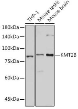 KMT2B Rabbit anti-Human, Mouse, Rat, Polyclonal, Novus Biologicals 100 &mu;g | Buy Online | Bio-Techne | Fisher Scientific