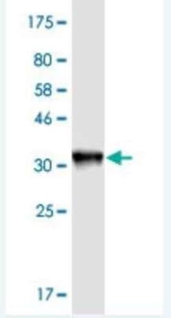 KNTC1 Antibody (10D9), Novus Biologicals 0.1 mg | Buy Online | Novus Biologicals | Fisher Scientific