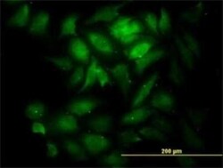 KNTC1 Antibody (10H4), Novus Biologicals 0.1 mg | Buy Online | Novus Biologicals | Fisher Scientific