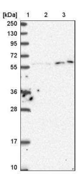 KPNA3 Antibody, Novus Biologicals 25 &mu;L | Buy Online | Novus Biologicals | Fisher Scientific