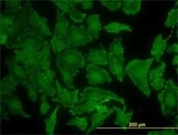 KRAS Antibody (3B10-2F2), Novus Biologicals 0.1 mg, Unconjugated:Antibodies,