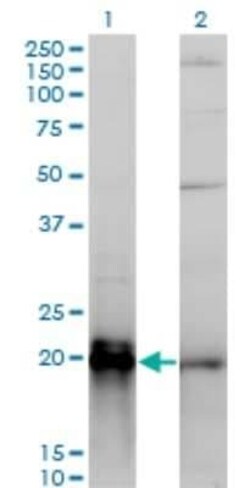 KRAS Antibody (3B10-2F2), Novus Biologicals 0.1 mg, Unconjugated:Antibodies,