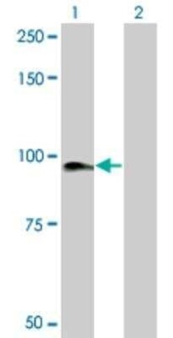 KRIT1 Antibody (2C7), Novus Biologicals 0.1 mg | Buy Online | Novus Biologicals | Fisher Scientific