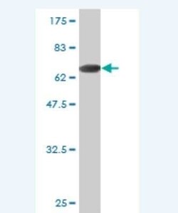 KRT23 Antibody (4H3-3D2), Novus Biologicals 0.1 mg | Buy Online | Novus Biologicals | Fisher Scientific