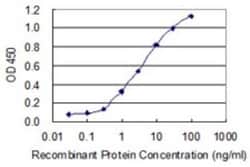 KRT34 Antibody (3E5), Novus Biologicals 0.1 mg | Buy Online | Novus Biologicals | Fisher Scientific
