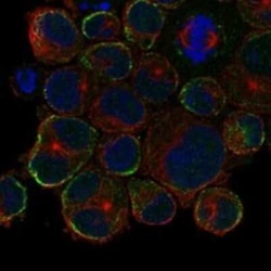 KRT35 Rabbit anti-Human, Polyclonal, Novus Biologicals 100 &mu;g | Buy Online | Novus Biologicals | Fisher Scientific