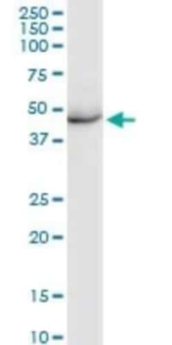 KRT35 Antibody, Novus Biologicals 0.1 mg, Unconjugated:Antibodies, Polyclonal
