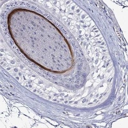 KRT40 Rabbit anti-Human, Polyclonal, Novus Biologicals 25 &mu;g | Buy Online | Novus Biologicals | Fisher Scientific