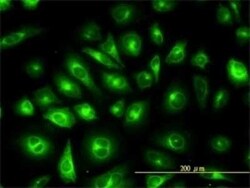 KRT81 Antibody (3B10-5B10), Novus Biologicals 0.1 mg | Buy Online | Novus Biologicals | Fisher Scientific