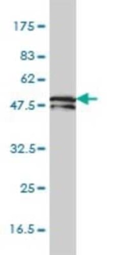 KRT81 Antibody (3B10-5B10), Novus Biologicals 0.1 mg | Buy Online | Novus Biologicals | Fisher Scientific