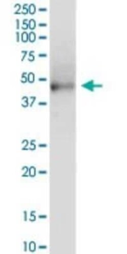 KRT81 Antibody, Novus Biologicals 0.1 mg | Buy Online | Novus Biologicals | Fisher Scientific