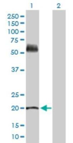 KRT81 Antibody, Novus Biologicals 0.1 mg | Buy Online | Novus Biologicals | Fisher Scientific
