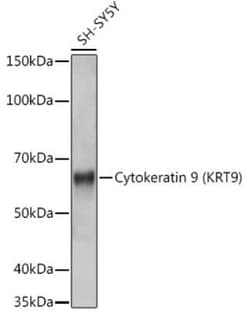 KRT9 Rabbit anti-Human, Mouse, Rat, Clone: 9A5H3, Novus Biologicals 20