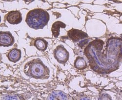 KRT9 Rabbit anti-Human, Clone: SD201-09, Novus Biologicals 100&mu;L:Antibodies,