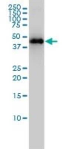 KRTHA3B Antibody (4A6-A7), Novus Biologicals 0.1 mg | Buy Online | Novus Biologicals | Fisher Scientific