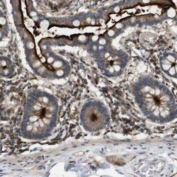 KSR1 Antibody, Novus Biologicals 25 &mu;L | Buy Online | Novus Biologicals | Fisher Scientific