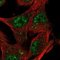 KTI12 Antibody, Novus Biologicals:Antibodies:Primary Antibodies