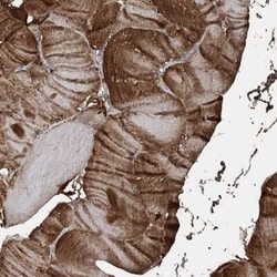 KY Antibody, Novus Biologicals:Antibodies:Primary Antibodies