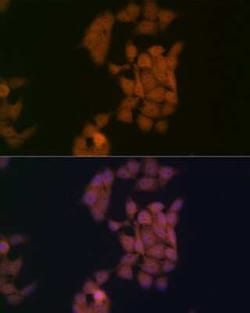 Kaiso Rabbit anti-Human, Mouse, Rat, Clone: 10O4V2, Novus Biologicals:Antibodies:Primary