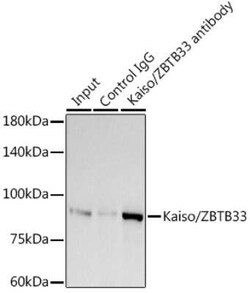 Kaiso Rabbit anti-Human, Mouse, Rat, Clone: 10O4V2, Novus Biologicals:Antibodies:Primary