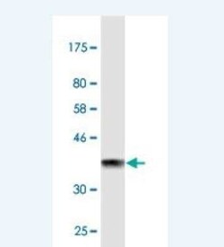 Kallikrein 1 Antibody (3D1), Novus Biologicals 0.1 mg | Buy Online | Novus Biologicals | Fisher Scientific