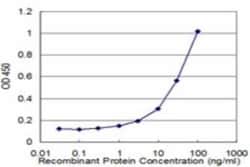 Kallikrein 10 Antibody (1B9), Novus Biologicals 0.1 mg | Buy Online | Novus Biologicals | Fisher Scientific