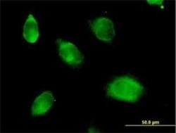 Kallikrein 10 Antibody, Novus Biologicals 0.05 mg | Buy Online | Novus Biologicals | Fisher Scientific