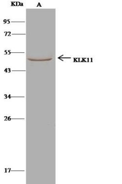 Kallikrein 11 Rabbit anti-Human, Clone: 121, Novus Biologicals 50 &mu;g;