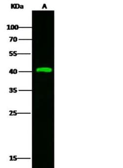 Kallikrein 11 Rabbit anti-Human, Clone: 121, Novus Biologicals 50 &mu;g;
