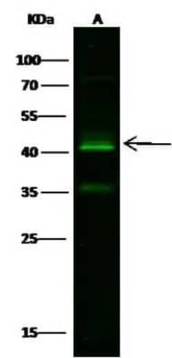 Kallikrein 11 Antibody, Novus Biologicals 100 &mu;g; Unconjugated:Antibodies,
