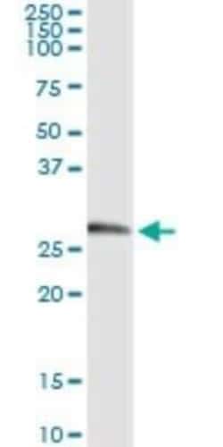Kallikrein 2 Antibody (3C5), Novus Biologicals 0.1 mg | Buy Online | Novus Biologicals | Fisher Scientific