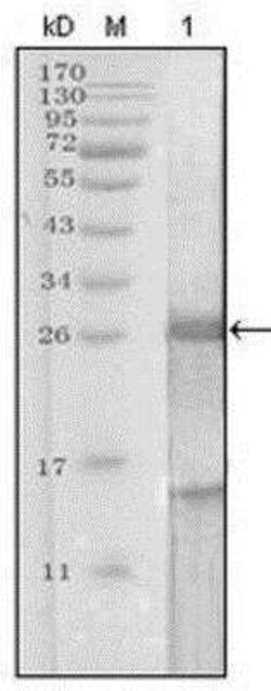 Kallikrein 3/PSA Antibody (5A11E9) - BSA Free, Novus Biologicals:Antibodies:Primary