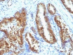 Kallikrein 3/PSA Antibody (A67-B/E3 + 1A7), Novus Biologicals 0.02mg; Unlabeled:Antibodies,