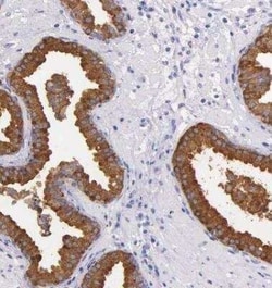 Kallikrein 3/PSA Antibody, Novus Biologicals:Antibodies:Primary Antibodies