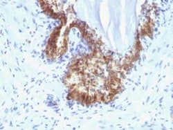 Kallikrein 3/PSA Antibody (KLK3/1248), Novus Biologicals 0.02mg; Unlabeled:Antibodies,