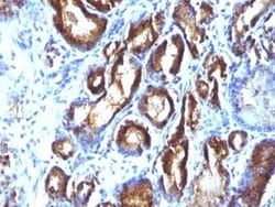 Kallikrein 3/PSA Antibody (KLK3/801 + KLK3/1248), Novus Biologicals:Antibodies:Primary