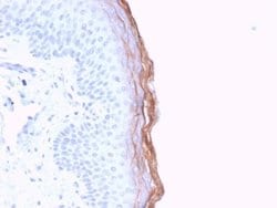 Kallikrein 5 Antibody (KLK5/3841) - Azide and BSA Free, Novus Biologicals 100 &mu;g | Buy Online | Novus Biologicals | Fisher Scientific