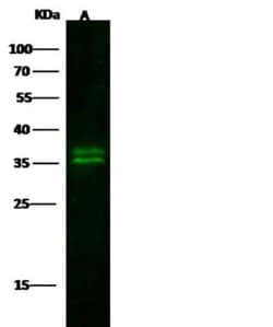 Kallikrein 8/Neuropsin Rabbit anti-Human, Clone: 140, Novus Biologicals