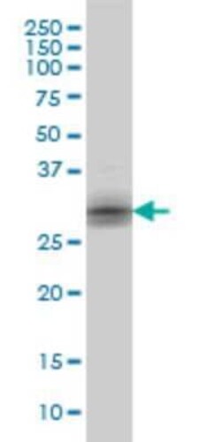 Kallikrein 8/Neuropsin Antibody (2F11), Novus Biologicals 0.1 mg | Buy Online | Novus Biologicals | Fisher Scientific