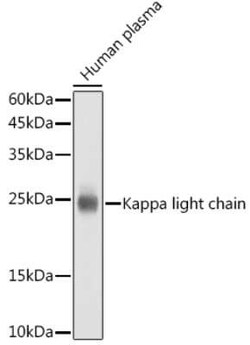 Kappa Light Chain Rabbit anti-Human, Clone: 8O7Q9, Novus Biologicals 20 &mu;g | Buy Online | Novus Biologicals | Fisher Scientific