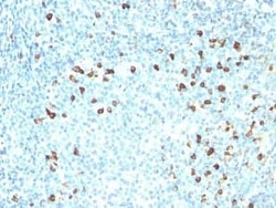 Kappa Light Chain Antibody (SPM558), Novus Biologicals 0.1 mg; Unconjugated:Antibodies,