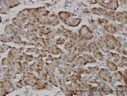Karyopherin (importin) beta 3 Antibody (1C4), Novus Biologicals 0.1 mg | Buy Online | Novus Biologicals | Fisher Scientific