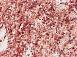 Ketohexokinase Antibody (1H6-2B6), Novus Biologicals 0.1 mg | Buy Online | Novus Biologicals | Fisher Scientific