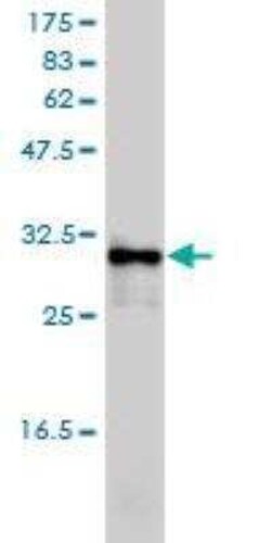 Ketohexokinase Antibody (1H6-2B6), Novus Biologicals 0.1 mg | Buy Online | Novus Biologicals | Fisher Scientific