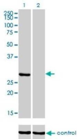 Ketohexokinase Antibody (1H6-2B6), Novus Biologicals 0.1 mg | Buy Online | Novus Biologicals | Fisher Scientific