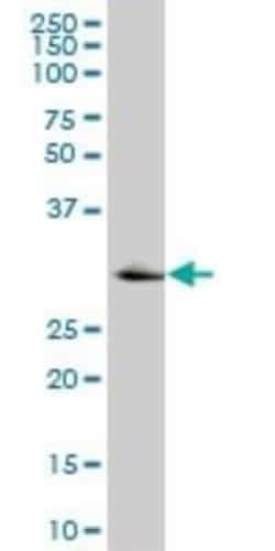 Ketohexokinase Antibody (2B1), Novus Biologicals 0.1 mg | Buy Online | Novus Biologicals | Fisher Scientific