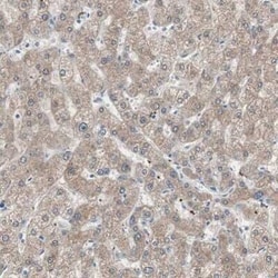 Ketohexokinase Antibody, Novus Biologicals 25 &mu;L | Buy Online | Novus Biologicals | Fisher Scientific