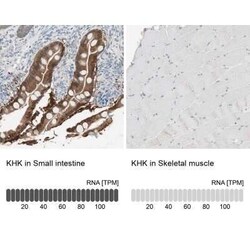 Ketohexokinase Antibody, Novus Biologicals 25 &mu;L | Buy Online | Novus Biologicals | Fisher Scientific
