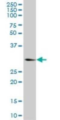 Ketohexokinase Antibody (S1), Novus Biologicals 0.1 mg | Buy Online | Novus Biologicals | Fisher Scientific