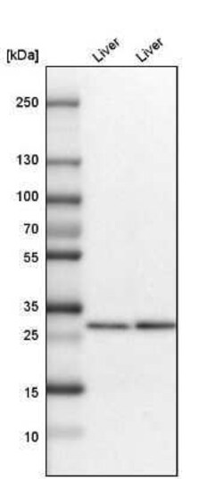 Ketohexokinase Antibody, Novus Biologicals 25 &mu;L | Buy Online | Novus Biologicals | Fisher Scientific